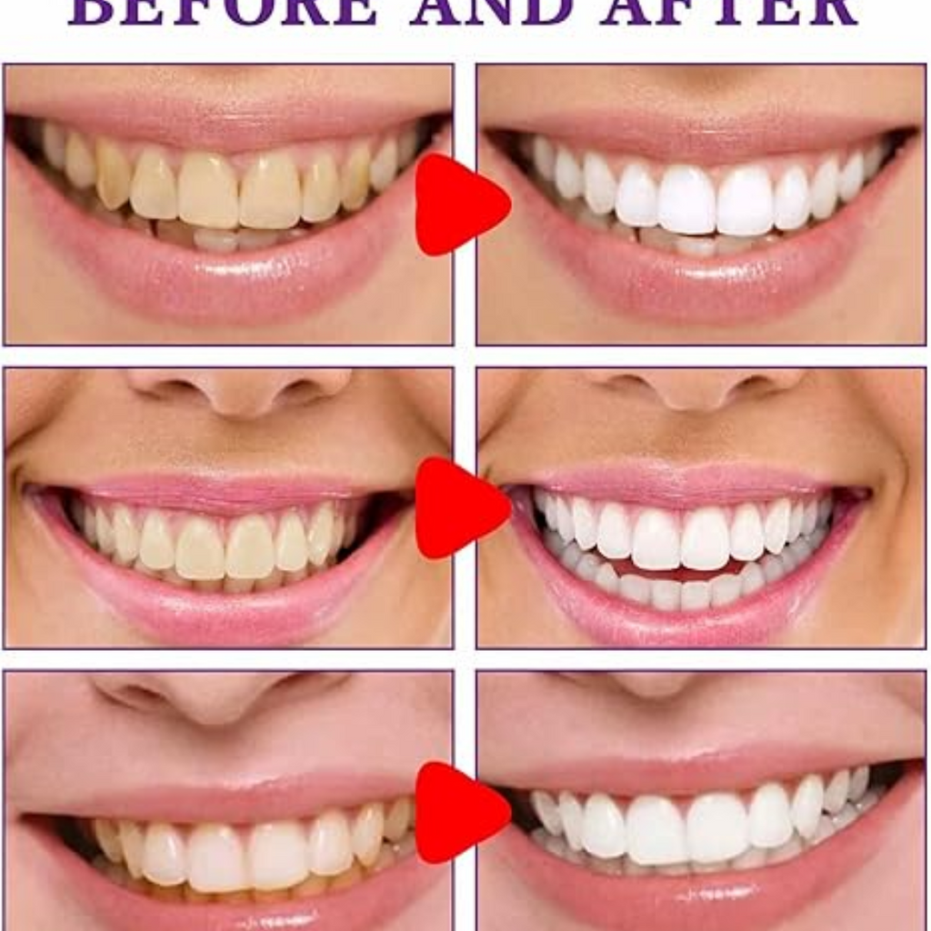 CREMA BLANQUEADORA DE DIENTES